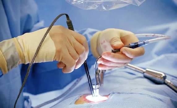 endoscopic spine surgery fl – Endoscopic Spine Surgery FL – Innovative and Minimally Invasive Solutions